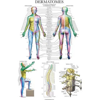 Palace Learning Dermatomes & Nervensystem Anatomisches Diagramm – Dermatome Anatomie Poster