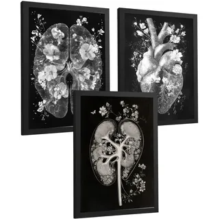 POSTER Set aus 3 Anatomie Drucke und Wandbilder mit Inneren Organen Gehirn Herz Nieren Minimalistisches Schwarz Weiß Design Größe Schwarzer Rahmen A3