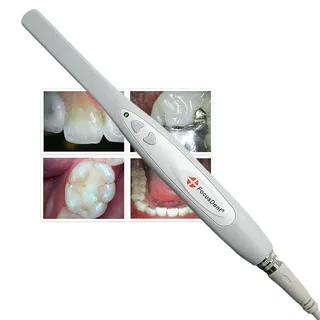 FocusDent MD740 Intraoralkamera für Zahnarztpraxis – USB Plug & Play – 6 LED – 1,3 MP CMOS – Bildbearbeitungssoftware enthalten