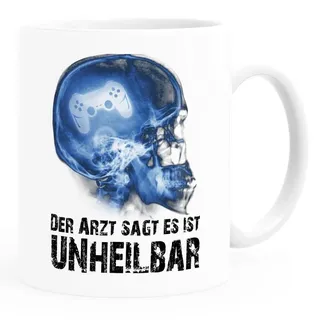 MoonWorks Tasse Kaffee-Tasse Der Arzt sagt es ist unheilbar Hobby Schädel Röntgenbild Schädel Controler Joypad Playstation Zocken Gamer Moonworks®, Keramik weiß